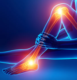 Stylized artwork of bone and joint pain.